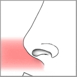 Sinus Cones insert comfortably into nasal airways
